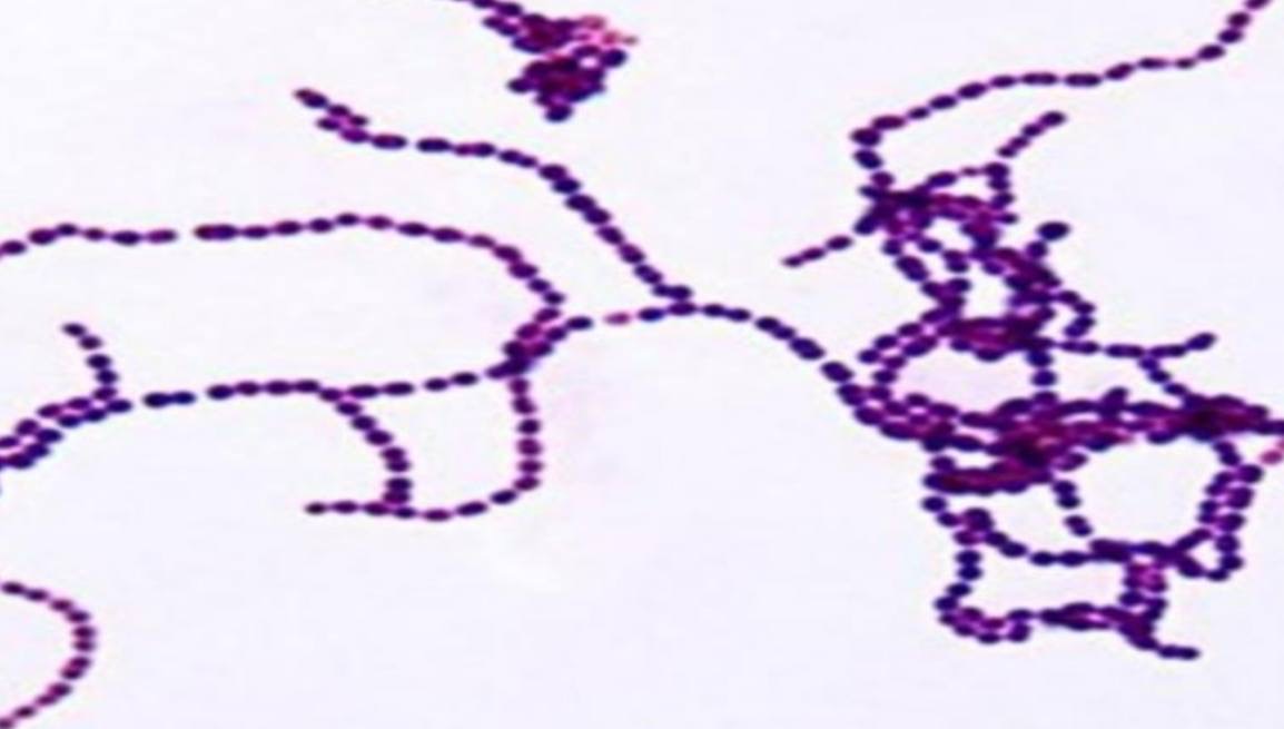 <p>Specimen (microscopically slide):</p><p>• Name of organism:</p><p>• Stain:</p><p>• Sample from: culture or pus or in tissue</p><p>• Morphology</p>