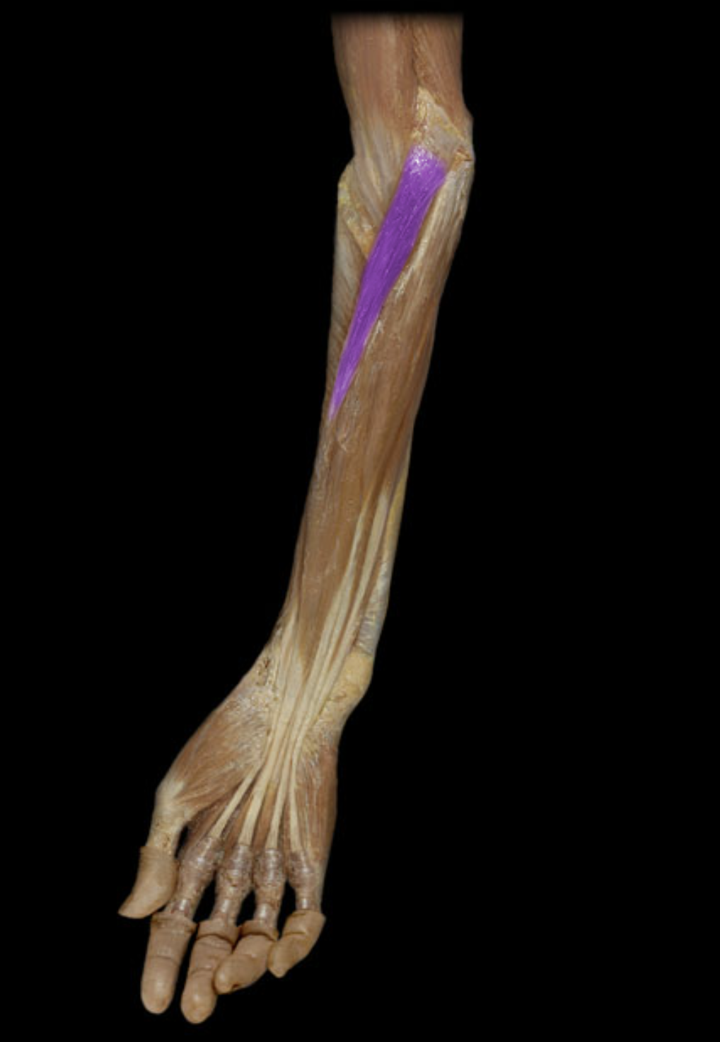 <p>What is the innervation of this muscle?</p>