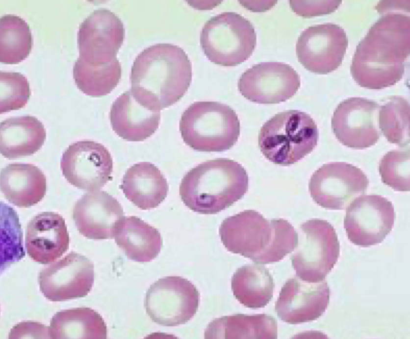 <p>What parasite is this?</p>