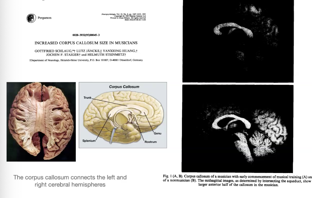 <ul><li><p>More communication between cerebral hemispheres</p></li><li><p>Musicians had larger anterior corpus callosum than nonmusicians</p></li><li><p>Larger in musicians who started training before 7 years of age than in those who started later</p></li></ul><p></p>
