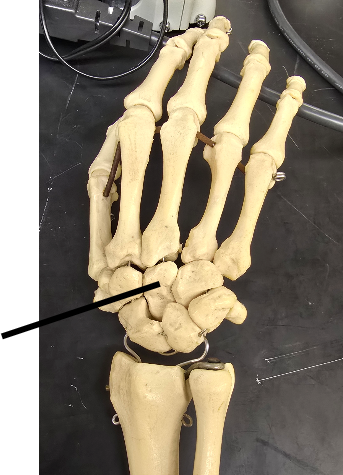 <p>Name Carpal Bone</p>