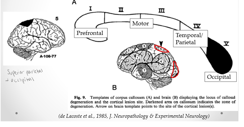 <p>Splenium. Occipital lobe</p>