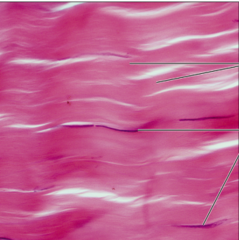 <p>name the tissue: primarily parallel collagen fibers; a few elastic fibers; major cell type is the fibroblast</p>