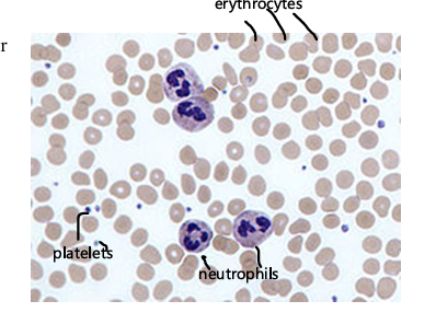 <p>biconcave discs, anucleate, filled with hemoglobin. function: transport oxygen to cells and carbon dioxide away from cells, lifespan of ~120 days, components recycled by liver and spleen after death</p>