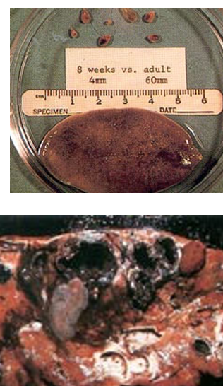 <p>Deer&nbsp;Liver&nbsp;Fluke</p>