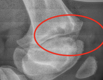 <p>Sepsis/physitis of what structures usually happens secondary to failure of passive transfer or hematogenous spread? It involves one or multiple limbs and can present with pyrexia, dullness, stiffness, swelling, and heat. Management includes blood culture, joint flush, managing other conditions, and fair/good prognosis if only in this location, but poor/guarded if involving multiple joints.</p>