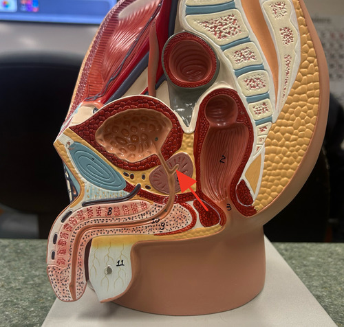 <p>fusion of the ductus deferens and seminal vesicle duct about one inch long</p>