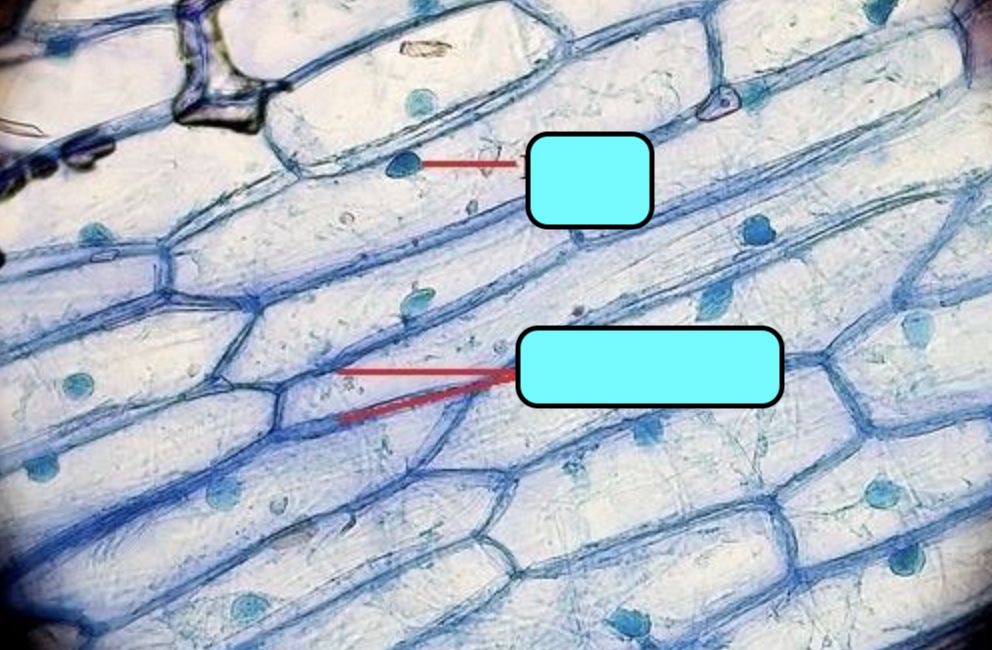 <p>Name specialized cells of plant under electron microscope</p>