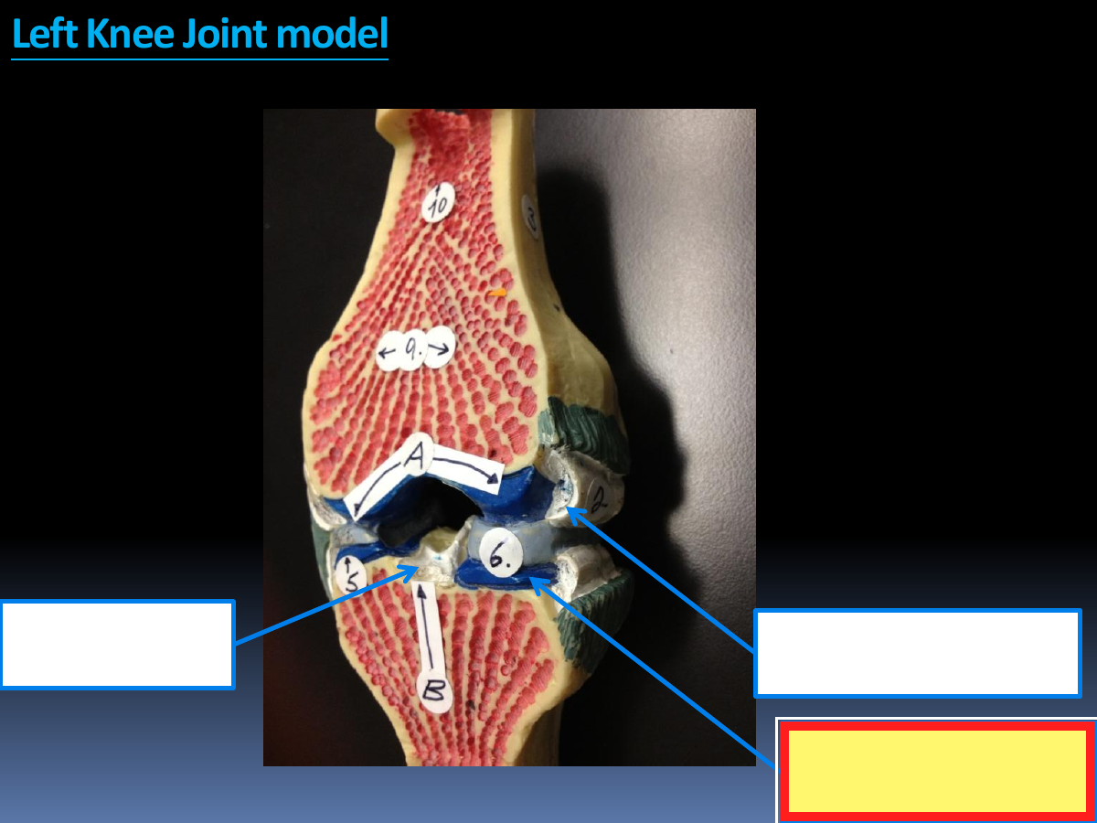 Identify the highlighted structure