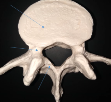 <p>What is this (lower portion/thin curve)?</p>