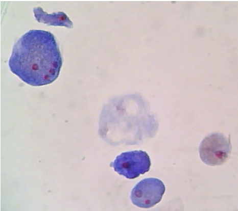 <ul><li><p><span>single-celled protozoan</span></p></li><li><p>causes amebiasis </p></li></ul><p></p>