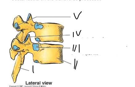 <p>What is II pointing at</p>