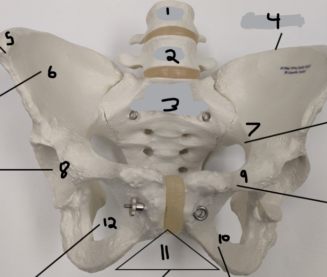 <p>what is pubic arch outlet?</p>
