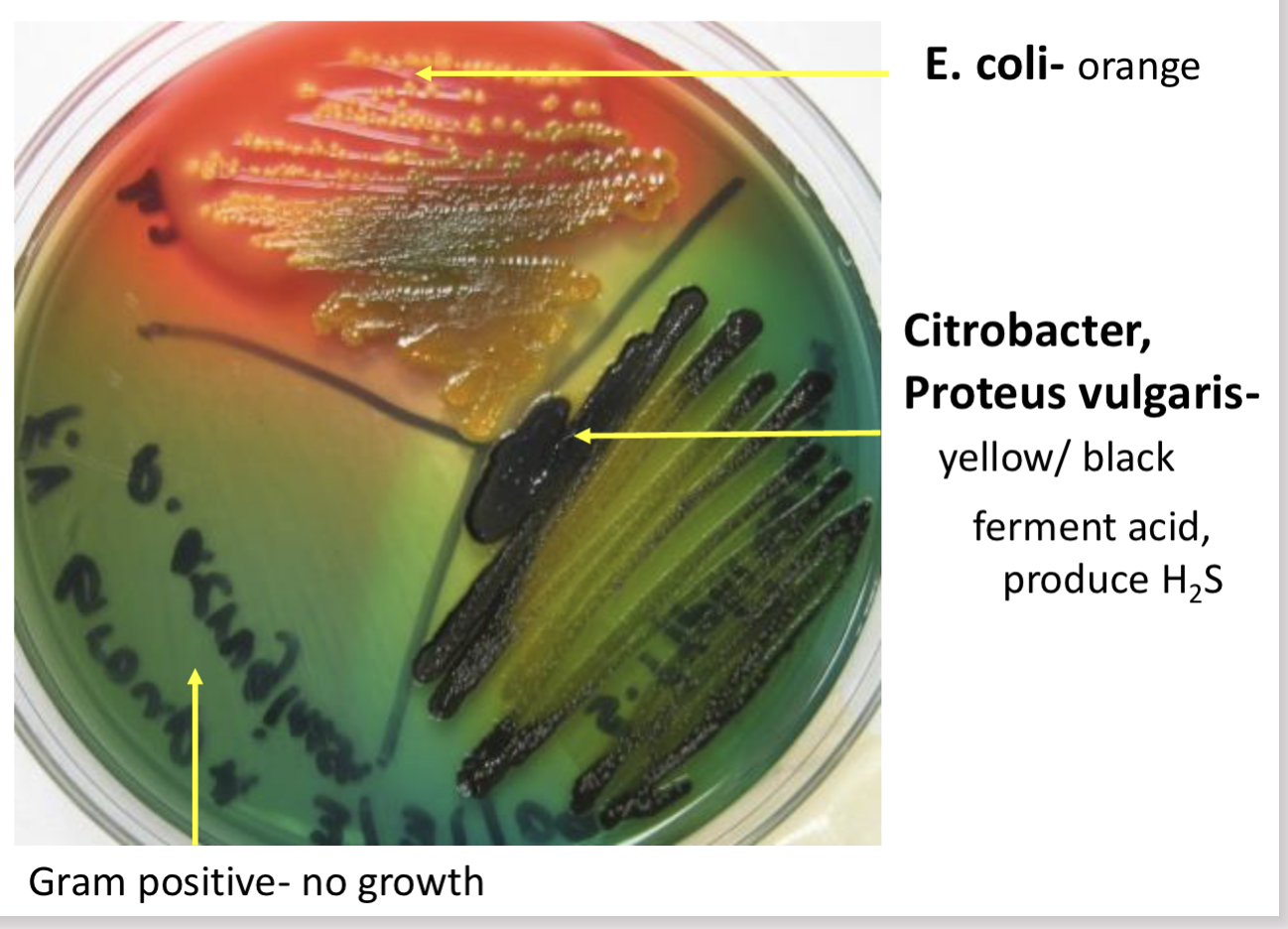<p>Hektoen enteric agar (HE) results-<strong> Proteus vulgaris, </strong>Citrobacter</p>