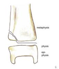 <p>A Fx through the Metaphysis & Physis (spares Epiphysis):</p><p>- Most common type</p><p>- May cause minimal shortening; however, long-term impairment is rare</p><p>- Creates a "Thurston Holland Corner Sign"</p>