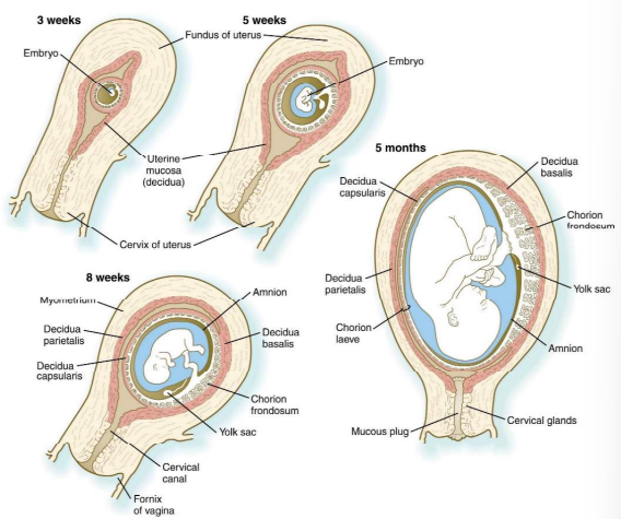 <p>• Early = trophoblast derivatives + extraembryonic mesoderm (Chorion) </p><p>• Chorion + cavity surrounds the embryo, amnion, yolk sac &amp; body stalk </p><p>• After implantation villi develop uniformly around the entire chorion </p><p>• Over time, tertiary villi preferentially colonise the region closest to the umbilical cord (embryonic pole) </p><p>• Villi on the opposite side (aembryonic pole) fail to thrive and atrophy </p><p>• At about 14 weeks the amnion and chorion fuse and become indistinguishable • Failure of complete chorioamniotic fusion can lead to premature birth or birth defects</p>