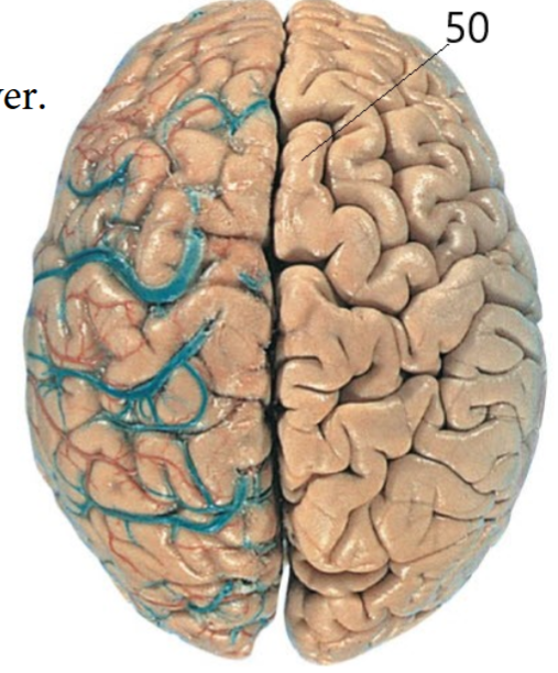<p>Name This Meningeal Layer</p>