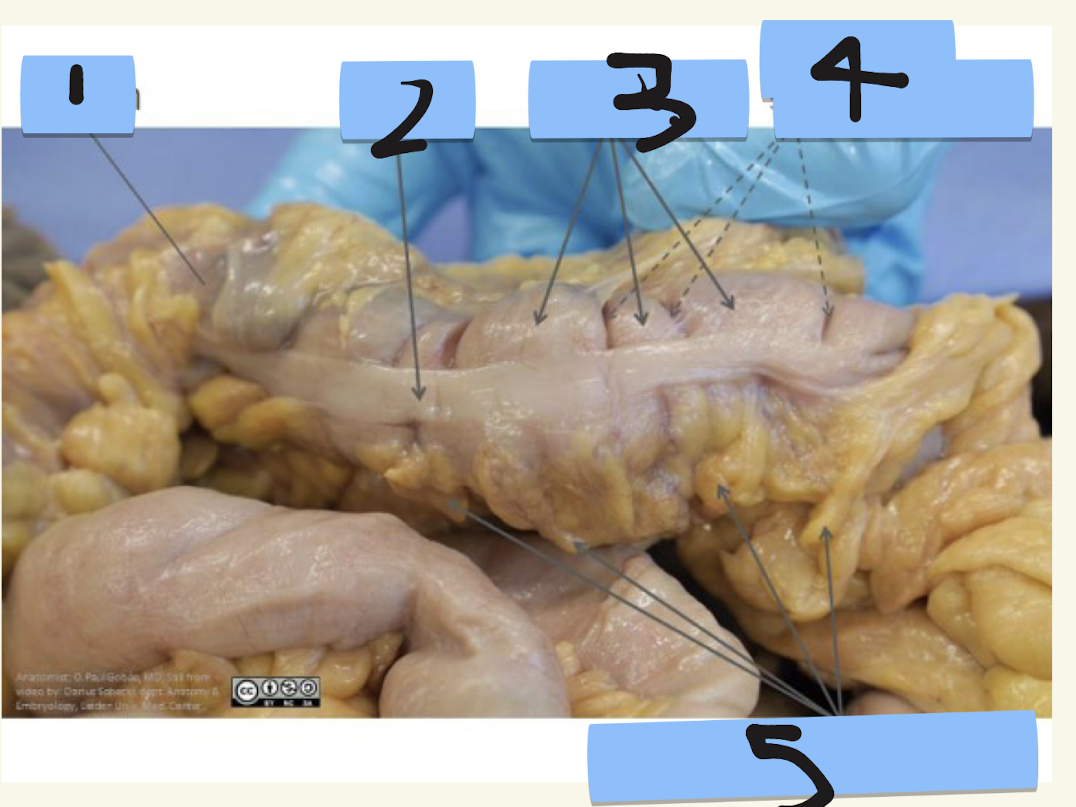 <p>Label structures 1-5</p>