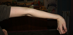 <p>to injure a body part (e.g., knee, elbow) by bending it beyond how far it should normally bend</p>