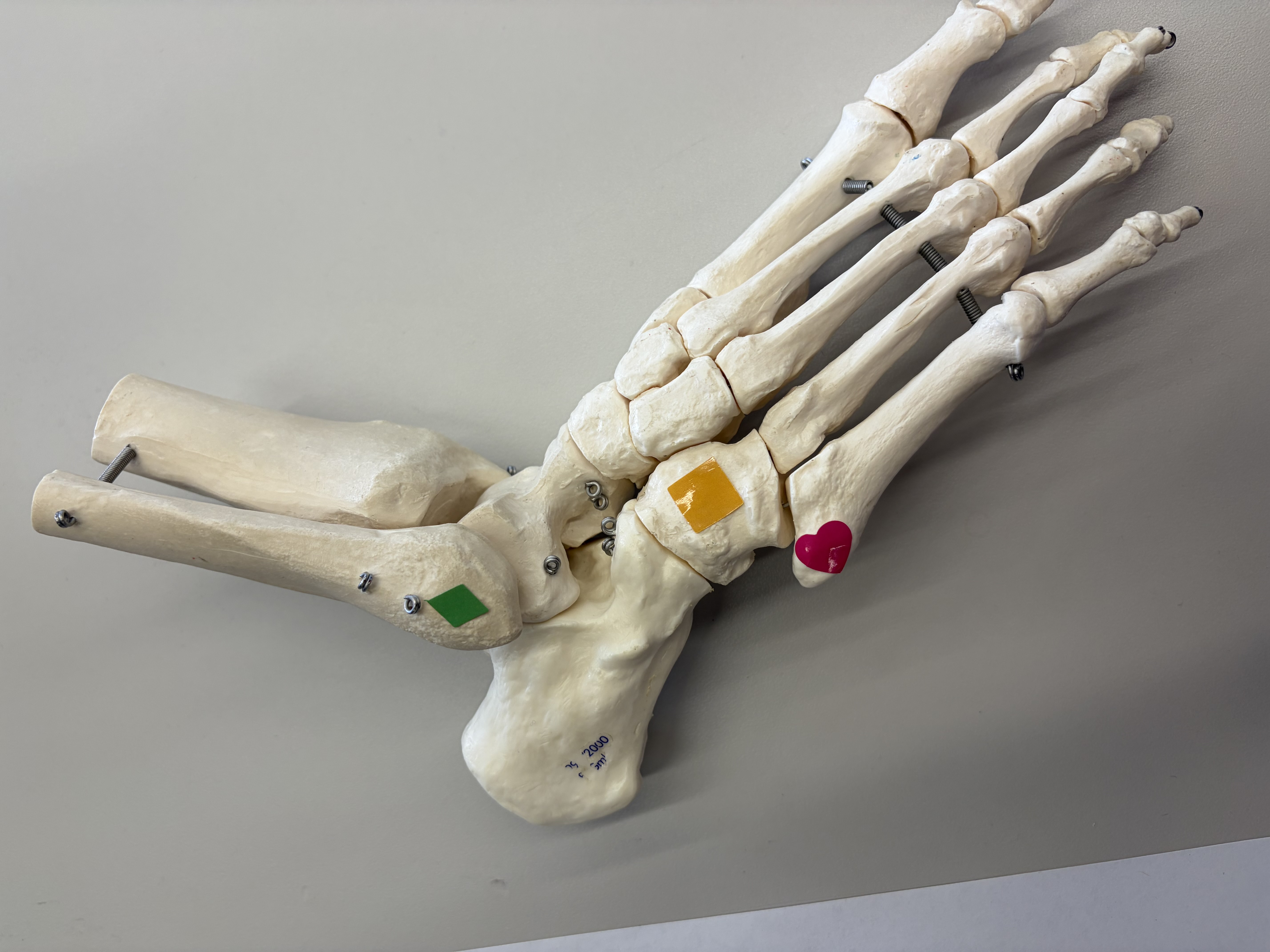 <p>Green: Name the structure </p><p>Yellow: Name the bone </p><p>Pink: Which muscles finds its insertion here? </p>
