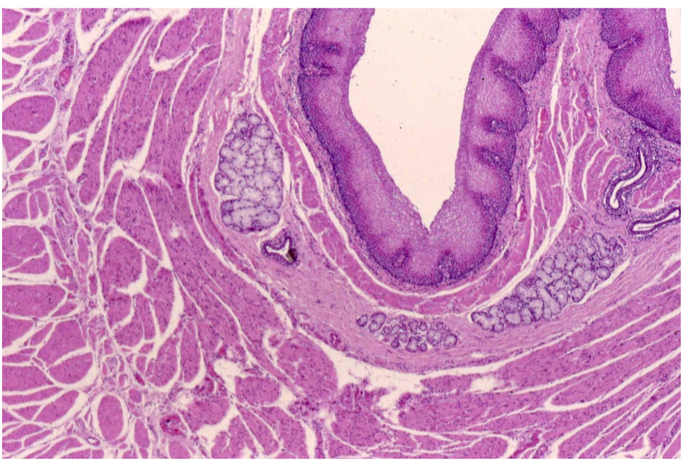 <p>-Esophagas </p><p>-Stratified squmous nonkeratinized</p>