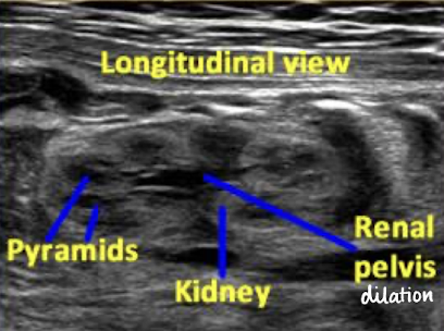 <p>longitudinal </p>