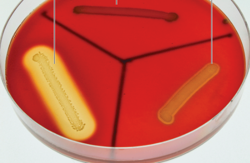 <p>How do you know if blood agar has completed lysis?</p>