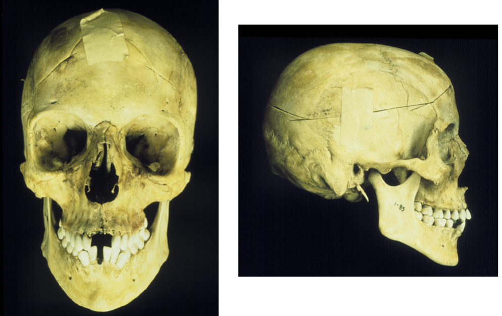 <p>what is the ancestry of this skull?</p>