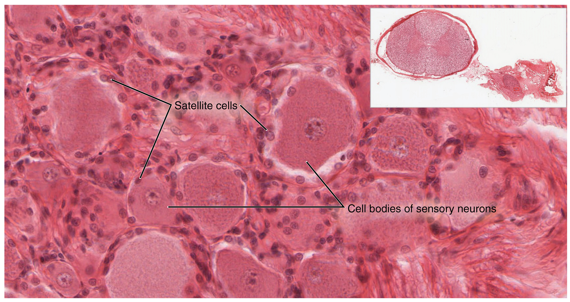 <p>Satellite cells</p>