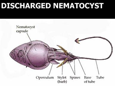 <p>harpoon-like filaments that are ejected through cindocytes and use stinging to immoblize small prey</p>