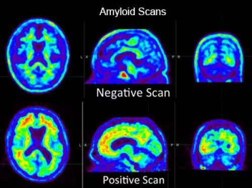 <p>What neuroimaging technique is this? </p>