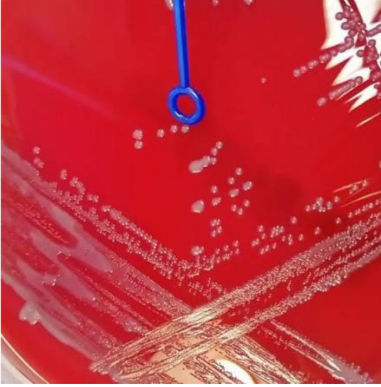 <p>Positive hockey puck sign is what pathogen</p>