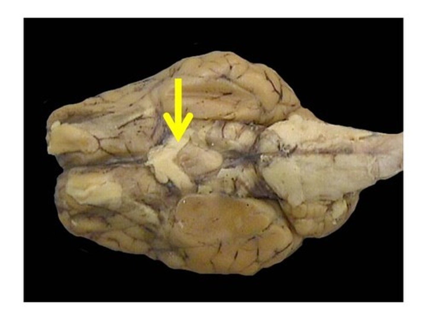 <p>-carries neural impulses from the eye to the brain</p><p>-inferior to olfactory bulb</p><p>-originates from forebrain</p>