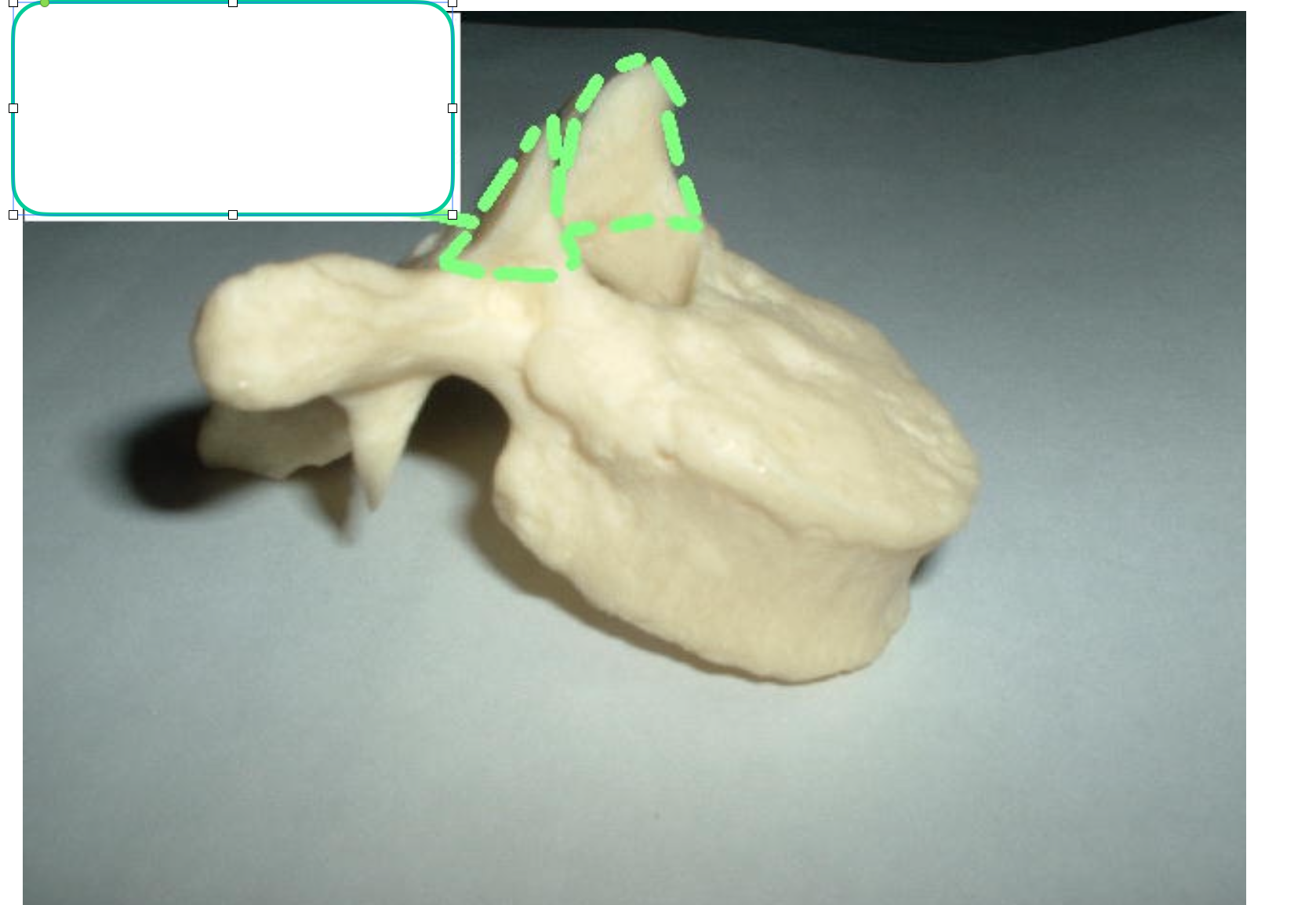 <p>articulates with inferior articular process</p>