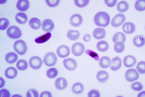 <p>Infects all sizes of RBCs</p><p>Small delicate ring forms</p><p>Banana shaped gametocytes</p>