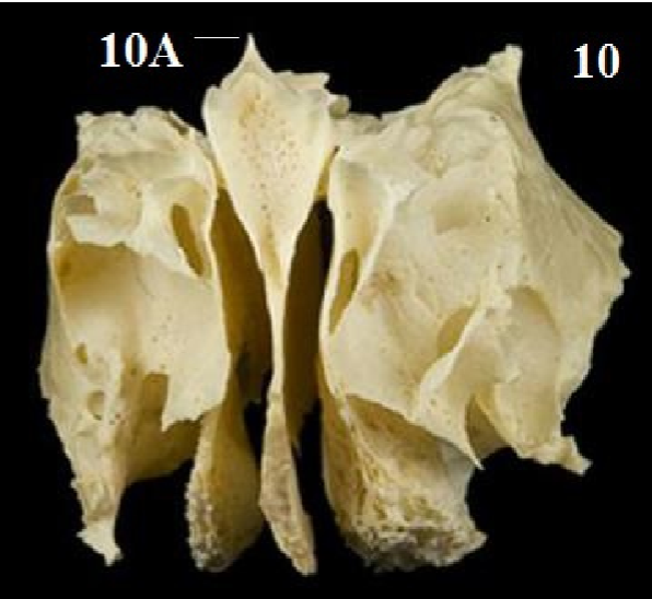 <p>Name the Structure denoted by 10A</p>