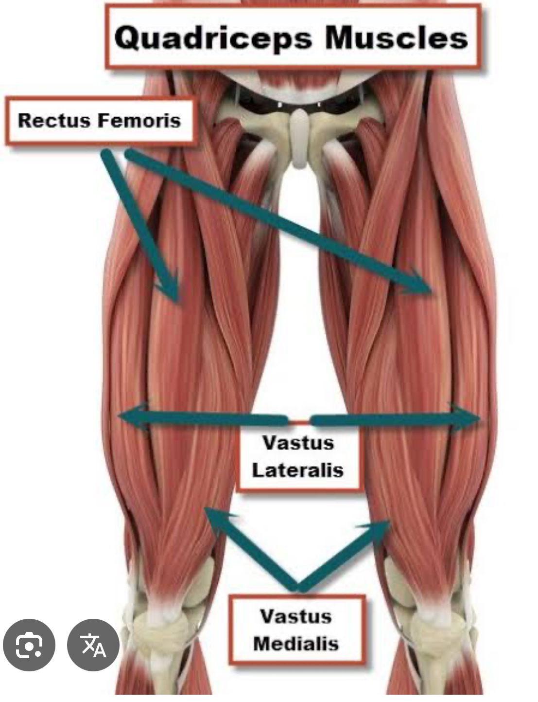 <p>Vastus medialis (anterior thigh) insertion</p>