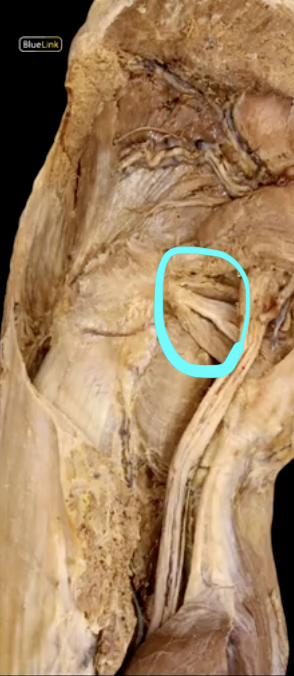 <p>What is the action of this group of muscles?</p>