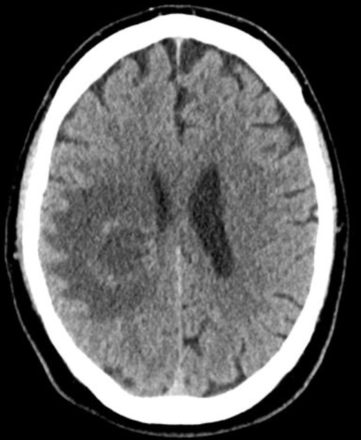 <p>Name the pathology </p>