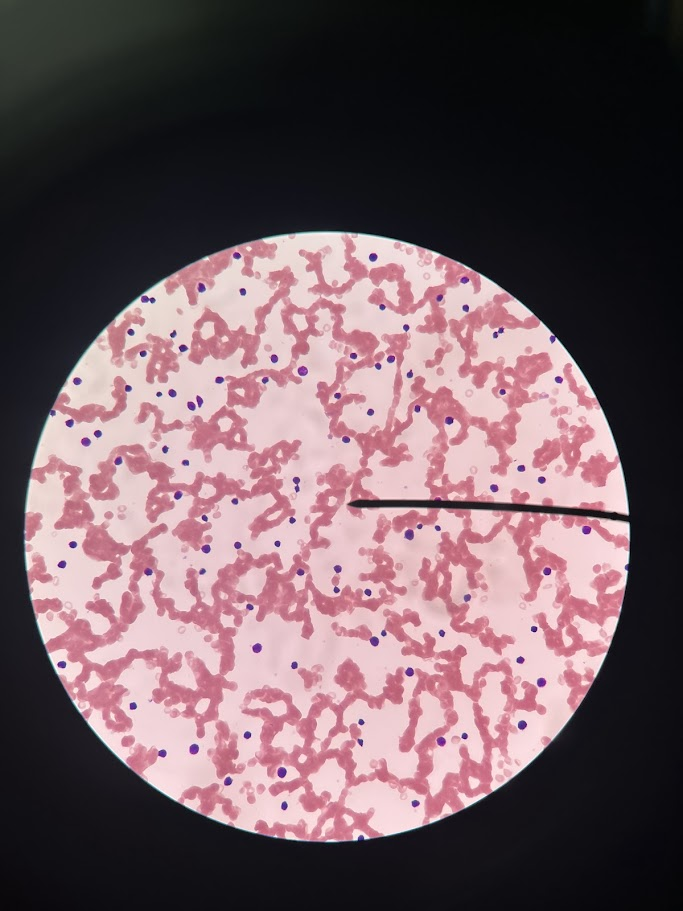 <p>This slide depicts which type of anemia</p>