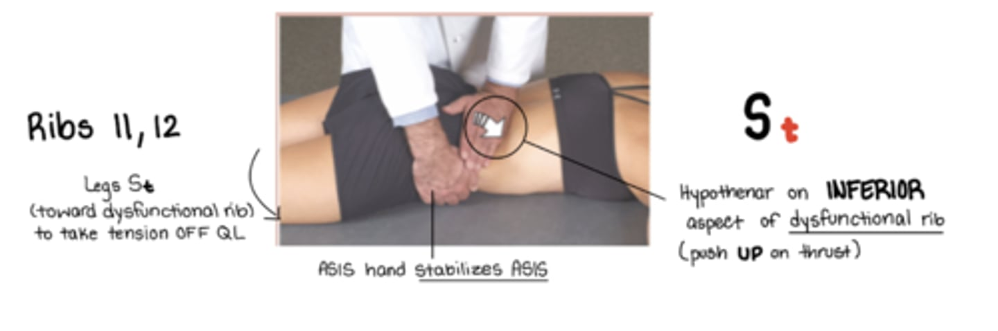 <p>inhalation sd</p><p>St = legs away from me</p><p>standing OPPOSITE side of dysfunctional rib</p><p>hypothenar eminence on inferior aspect of dysfunctional rib - to push rib back UP</p><p>(other hand stabilizes on ASIS)</p><p>ribs stuck DOWN</p>