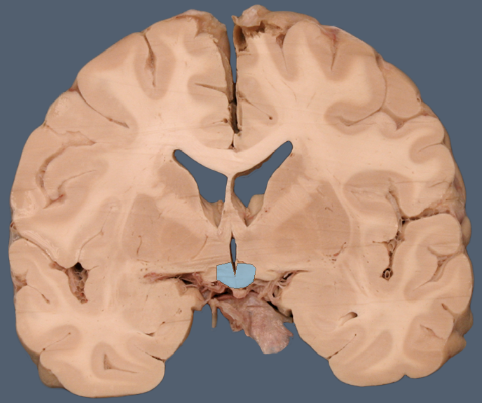 term image