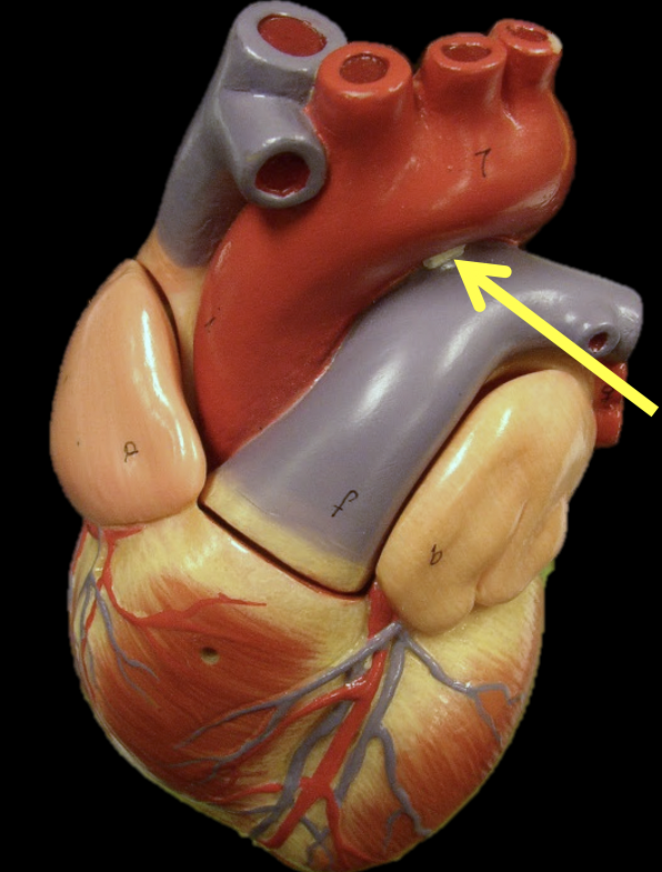 <p>Identify the structure</p>