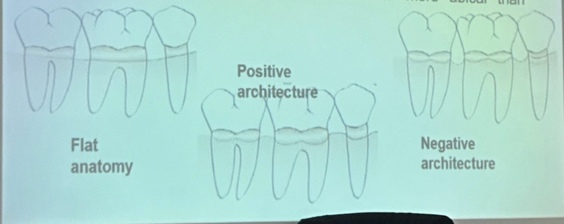 <p><strong>Ideal</strong> = interdental bone more coronal interproximally than on B/L + gradual curved slopes between interdental peaks </p><p><strong>Flat</strong> = interdental and radicular bone at the same height</p><p><strong>Positive</strong> = interdental bone higher than radicular bone</p><p><strong>Negative</strong> = interdental bone more apical (lower) than radicular bone</p>