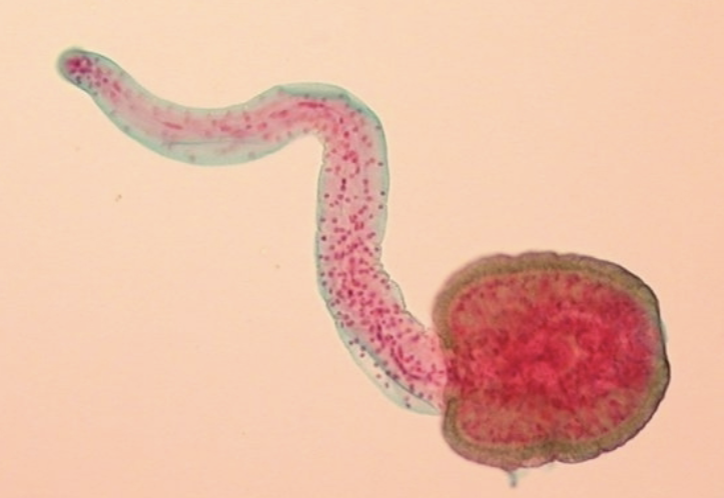 <p>What helminth/fluke/parasitic worm is this?</p>