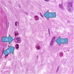 <p>Which of these cells is an eosinophil?</p>