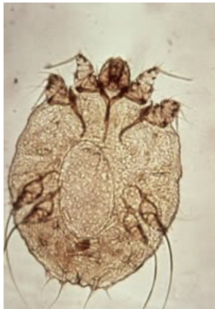 <img src="blob:null/24f5f497-8bc3-49eb-8d73-67dd22b7e6ac" width="201" height="309"><p></p>