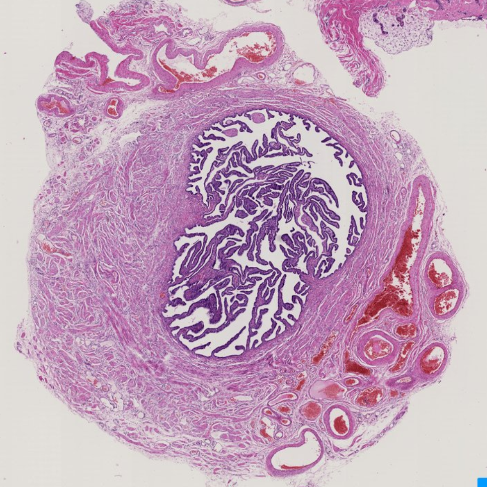 <p>What part of the body is seen in this image? </p>