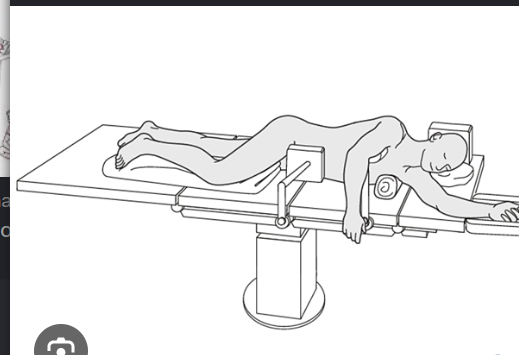 <p>What scan plane can image renal artery origins from the front?<br>→ Transverse midline anterior approach</p><p>What patient position is used for coronal renal artery imaging?<br>→ Decubitus position</p><p>What transducer approach may be used in decubitus imaging?<br>→ Posterolateral approach</p><p>What acts as the acoustic window for renal artery imaging?<br>→ Kidney</p>