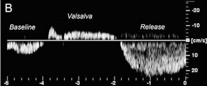 <p><strong>normal or abn</strong></p>